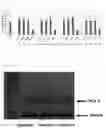 Fig. 06 - Bee venom-purifying method comprising viral clearance process and composition for preventing or treating inflammatory disease by using same