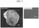 Fig. 02 - METHOD FOR FORECASTING ARRIVAL OF DRUG INSIDE DISEASED TISSUE