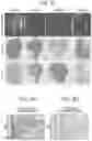 Fig. 05 - METHOD FOR FORECASTING ARRIVAL OF DRUG INSIDE DISEASED TISSUE