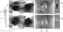 Fig. 01 - System and method for artifact reduction in an image