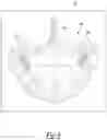 Fig. 04 - System and method for artifact reduction in an image