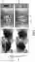 Fig. 06 - System and method for artifact reduction in an image