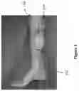 Fig. 02 - SYSTEMS, METHODS AND COMPUTER PROGRAM PRODUCT FOR MONITORING VASCULAR PERFUSION IN REPLANTED TISSUE FLAPS