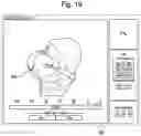 Fig. 19 - System and method for verifying calibration of a surgical system