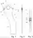 Fig. 02 - JOINT FOR AN ANKLE ORTHOSIS