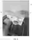 Fig. 02 - Immersive distraction therapy