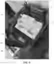 Fig. 06 - Immersive distraction therapy
