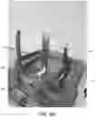 Fig. 08 - Immersive distraction therapy