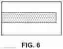 Fig. 07 - Systems and methods for manufacturing 3D printed medical devices