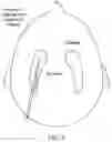 Fig. 06 - Neurosurgical apparatus and method