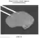 Fig. 08 - Neurosurgical apparatus and method