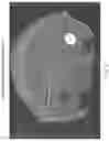 Fig. 09 - Neurosurgical apparatus and method