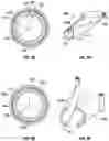 Fig. 07 - Splitable Needle and Dilator Catheter Placement Device and Associated Methods