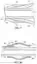 Fig. 10 - Enhanced Balloon Bonding For Balloon Guide Catheters While Minimizing Outer Profiles