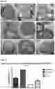 Fig. 24 - METHODS FOR AGGREGATION OF PROTEINS