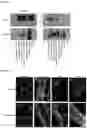 Fig. 59 - METHODS FOR AGGREGATION OF PROTEINS