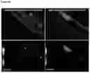 Fig. 69 - METHODS FOR AGGREGATION OF PROTEINS
