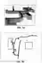 Fig. 08 - System for navigating in cavities