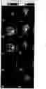 Fig. 02 - Method to Detect Perfusion and Brain Functional Activities Using Hyperpolarized 129Xe MRI