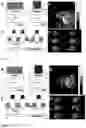 Fig. 03 - Method to Detect Perfusion and Brain Functional Activities Using Hyperpolarized 129Xe MRI