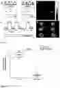 Fig. 04 - Method to Detect Perfusion and Brain Functional Activities Using Hyperpolarized 129Xe MRI