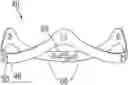 Fig. 01 - EXPANDABLE SURGICAL HEART VALVE INDICATORS