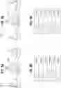 Fig. 06 - EXPANDABLE SURGICAL HEART VALVE INDICATORS