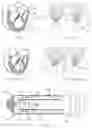 Fig. 02 - Transcatheter prosthetic valve replacement system