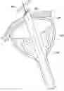 Fig. 01 - Methods, implants, and systems for treatment of mitral valve prolapse