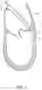 Fig. 03 - Methods, implants, and systems for treatment of mitral valve prolapse