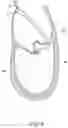 Fig. 07 - Methods, implants, and systems for treatment of mitral valve prolapse
