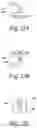 Fig. 14 - Methods, implants, and systems for treatment of mitral valve prolapse