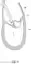 Fig. 23 - Methods, implants, and systems for treatment of mitral valve prolapse