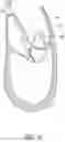 Fig. 24 - Methods, implants, and systems for treatment of mitral valve prolapse