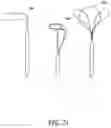 Fig. 25 - Methods, implants, and systems for treatment of mitral valve prolapse