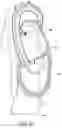 Fig. 26 - Methods, implants, and systems for treatment of mitral valve prolapse