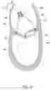 Fig. 27 - Methods, implants, and systems for treatment of mitral valve prolapse