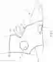 Fig. 02 - BRACE OR SUPPORT WITH ATFL SUPPORT