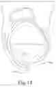 Fig. 14 - BRACE OR SUPPORT WITH ATFL SUPPORT