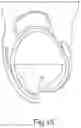 Fig. 15 - BRACE OR SUPPORT WITH ATFL SUPPORT