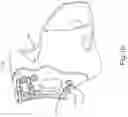 Fig. 16 - BRACE OR SUPPORT WITH ATFL SUPPORT