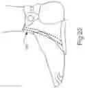Fig. 22 - BRACE OR SUPPORT WITH ATFL SUPPORT