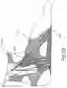 Fig. 26 - BRACE OR SUPPORT WITH ATFL SUPPORT