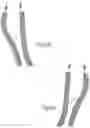 Fig. 28 - BRACE OR SUPPORT WITH ATFL SUPPORT