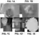 Fig. 02 - Urchin-shaped nanocrystalline material