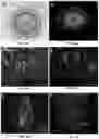 Fig. 10 - MULTIPOTENT ADULT STEM CELLS: CHARACTERIZATION AND USE