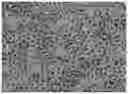 Fig. 02 - Serum-free complete medium for inducing differentiation of a mesenchymal stem cell to a corneal epithelial cell