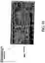 Fig. 12 - Identification of a JAK2 Mutation in Polycythemia Vera