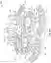 Fig. 49 - ASSEMBLY AND SYSTEM INCLUDING A BIOLOGICAL SAMPLE TREATMENT CHAMBER
