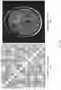 Fig. 07 - Deriving target data from selected brain data